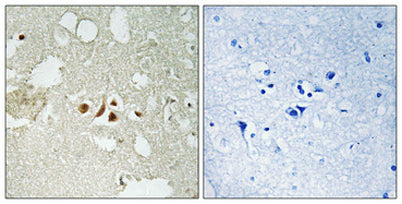 Smad2 (phospho Thr220) rabbit pAb