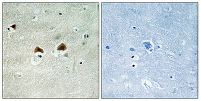 MAP-4 (phospho Ser696) rabbit pAb