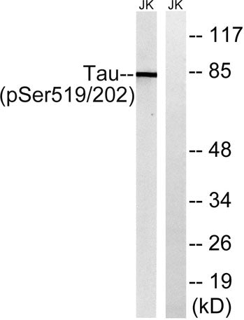 Tau (phospho Ser519) rabbit pAb