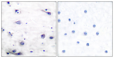 Tau (phospho Ser422) rabbit pAb