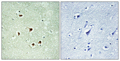 Max (phospho Ser2) rabbit pAb