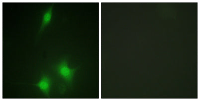 MDM2 rabbit pAb