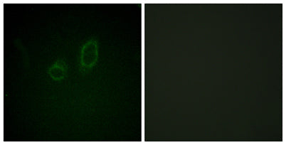 Moesin/Ezrin/Radixin (phospho Thr558) rabbit pAb