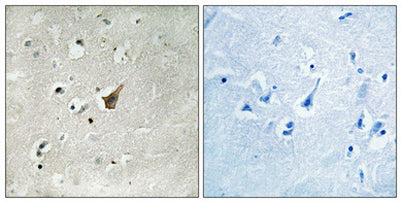 Mucin 1 (phospho Ser1227) rabbit pAb