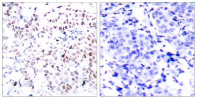 c-Myc (phospho Thr358) rabbit pAb