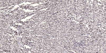MYLK (phospho Tyr464) rabbit pAb