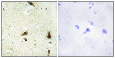 CHRAC15 rabbit pAb