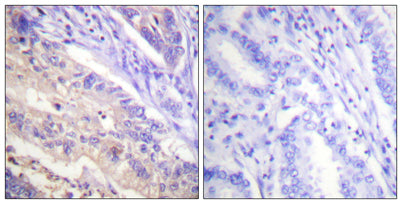 PTEN (phospho Ser385) rabbit pAb