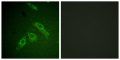 FAK (phospho Ser910) rabbit pAb