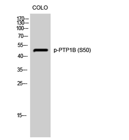 PTP1B (phospho Ser50) rabbit pAb