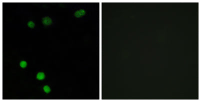 TP53INP2 rabbit pAb