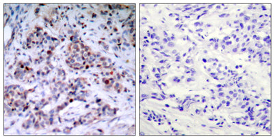 NFκB-p65 (phospho Thr435) rabbit pAb