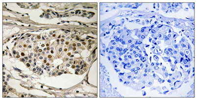 NFκB-p65 (phospho Ser281) rabbit pAb
