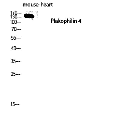 Plakophilin 4 rabbit pAb