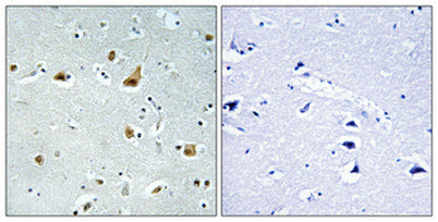 Ribosomal Protein L5 rabbit pAb