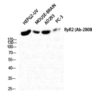 RyR-2 rabbit pAb