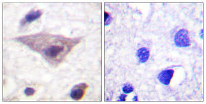 Synuclein-α (phospho Ser129) rabbit pAb