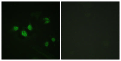Sp1 (phospho Thr453) rabbit pAb