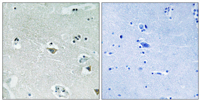 SREBP-1 (phospho Ser439) rabbit pAb