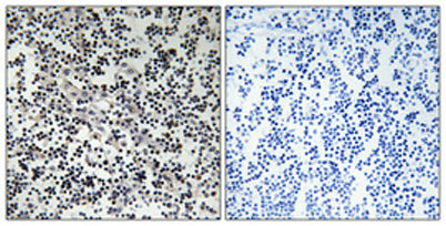 Thymidine Kinase rabbit pAb