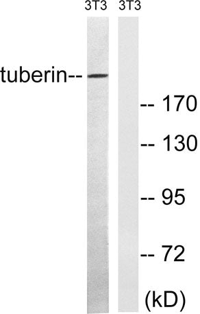 Tuberin rabbit pAb