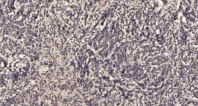 VASP (phospho Thr278) rabbit pAb