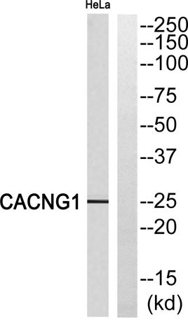 L-type Ca++ CP γ1 rabbit pAb