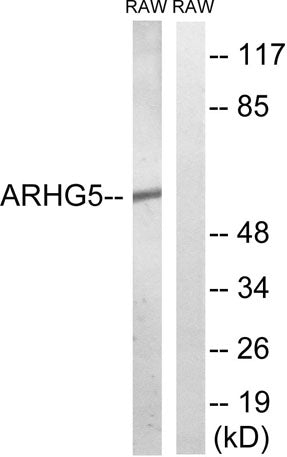 Oncogene TIM rabbit pAb