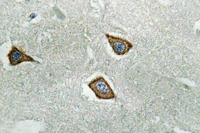 Calpain 2 rabbit pAb