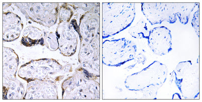 ELOVL3 rabbit pAb