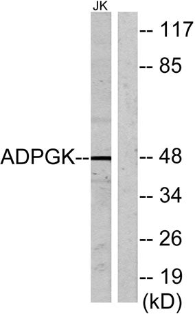 ADP-GK rabbit pAb