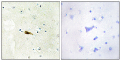 MOF rabbit pAb