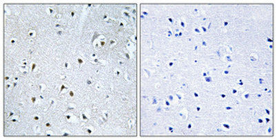 POLDIP3 rabbit pAb