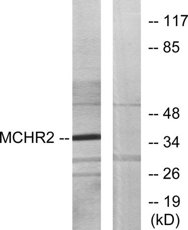 MCH-2R rabbit pAb