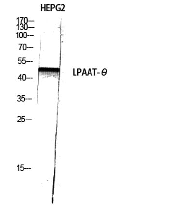 LPAAT-θ rabbit pAb