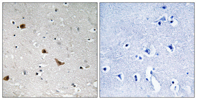 IKKγ (phospho Ser376) rabbit pAb