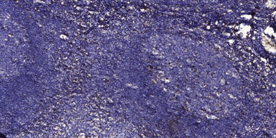 SerpinA6 rabbit pAb