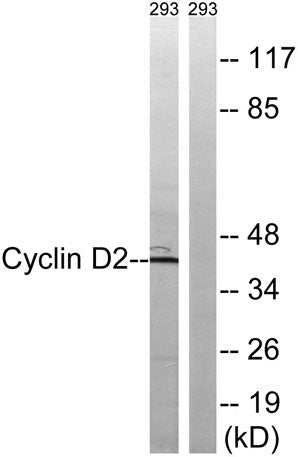 Cyclin D2 rabbit pAb