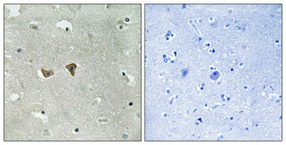 Lfc (phospho Ser886) rabbit pAb