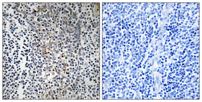 Ribosomal Protein L23 rabbit pAb