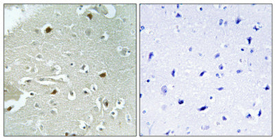 HAND1 (phospho Ser98) rabbit pAb