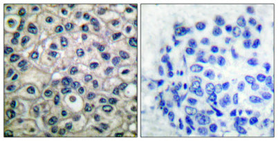 p130 Cas (phospho Tyr410) rabbit pAb
