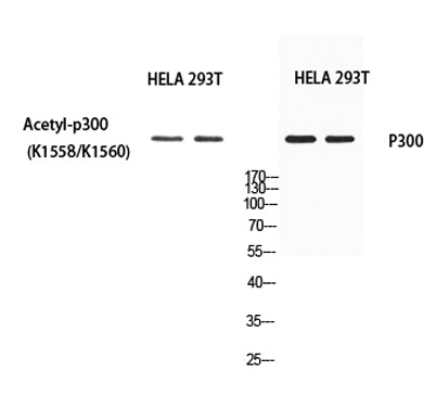 p300 (Acetyl Lys1558/Acetyl Lys1560) rabbit pAb