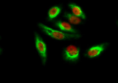 Amyloid-β rabbit pAb