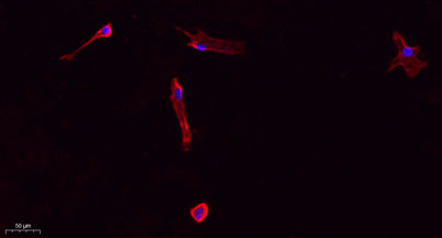 Collagen I rabbit pAb