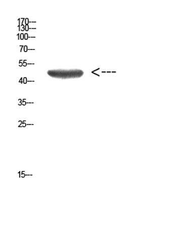 Cytokeratin 14/17 rabbit pAb
