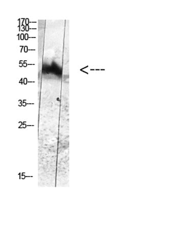MDM2 (Phospho-Tyr394) Rabbit pAb