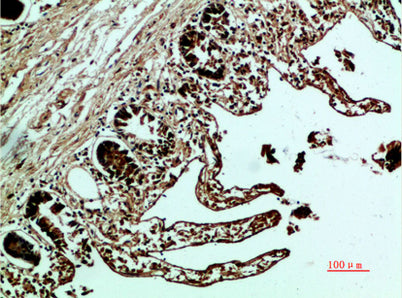 Fibronectin rabbit pAb