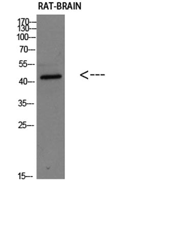 Corticotropin-releasing factor receptor 2 rabbit pAb