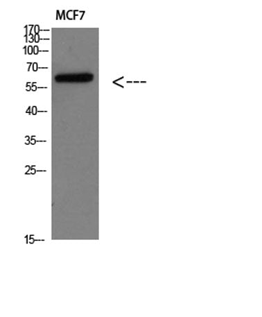 Parathyroid hormone/parathyroid hormone-related peptide receptor rabbit pAb